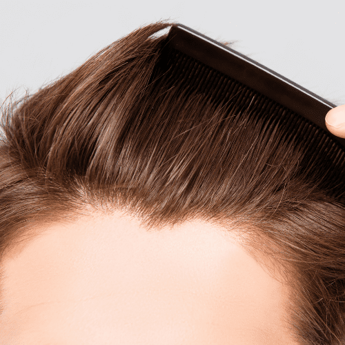 hairstyles for men thin hair big forehead
